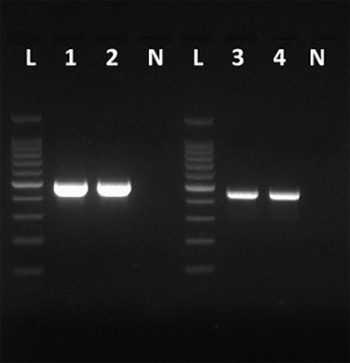 Whole Genome Sequencing of Hepatitis A Virus Using a PCR-Free Single-Molecule Nanopore Sequencing Approach